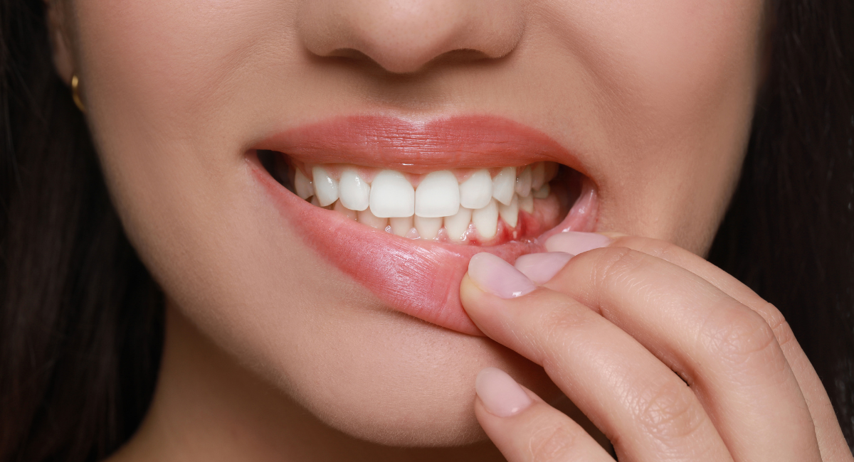 סילון מים לניקוי החניכיים - שגרת ניקוי קצרה שעובדת